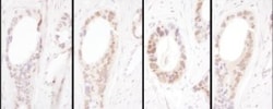 HNF1 Antibody, Novus Biologicals 0.1mg; Unlabeled:Antibodies, Polyclonal